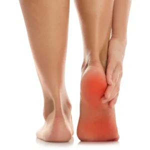 Plantar fasciitis