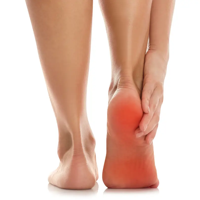Plantar fasciitis